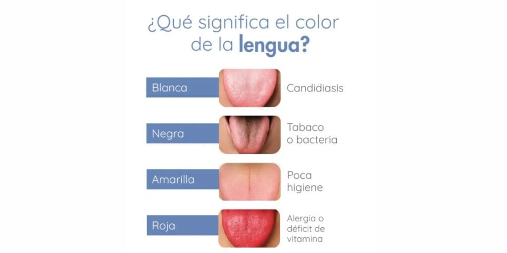 como eliminar síntomas de lengua blanca naturalmente - savesalud
