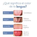 como eliminar síntomas de lengua blanca naturalmente - savesalud